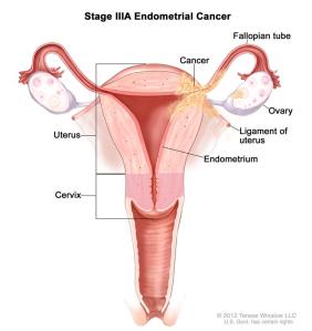 GLA Shaklee endometriosis